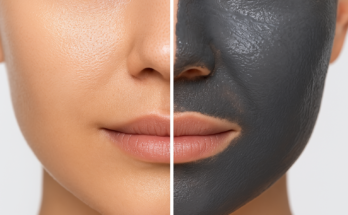 The Amazing Benefits of Charcoal Masks