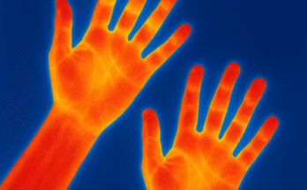 Why Are My Hands Always Hot? Uncovering the Surprising Reasons Behind Warm Palms