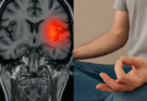 Understanding Hand Tremors: Causes, Treatments, and Practical Solutions