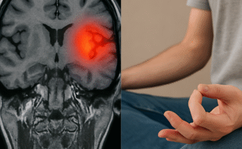hand tremors, essential tremor treatment, Parkinson’s disease symptoms, caffeine and shaking, stress-induced tremors.